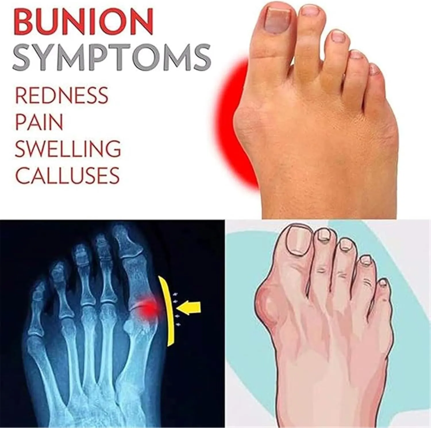 Summer Breathable Slip-On Arch Support Bunion Corrector Sandals for Men's, Casual Durable Two Uses Split Toe PU Non-slip Beach Sandals, for Dad Men Grandpa, Arch of Foot, Foot Correction(Black,8)