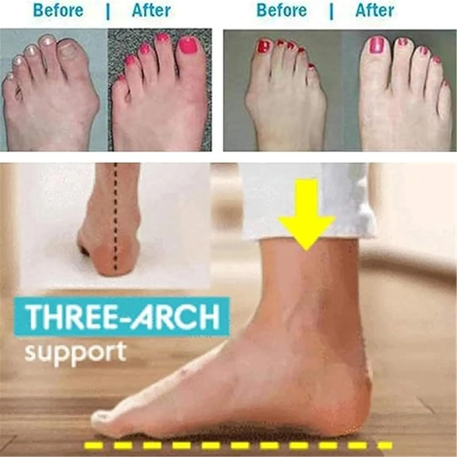 Summer Breathable Slip-On Arch Support Bunion Corrector Sandals for Men's, Casual Durable Two Uses Split Toe PU Non-slip Beach Sandals, for Dad Men Grandpa, Arch of Foot, Foot Correction(Black,8)